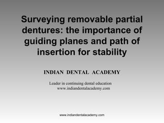 Surveying removable partial
dentures: the importance of
guiding planes and path of
insertion for stability
INDIAN DENTAL ACADEMY
Leader in continuing dental education
www.indiandentalacademy.com
www.indiandentalacademy.com
 