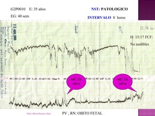 1. fisiopatologia del dip[1] | PPT