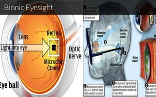 Bionic Eyesight
 