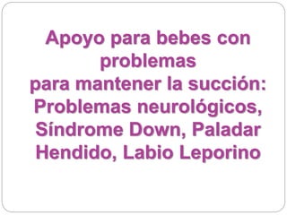 Apoyo para bebes con
problemas
para mantener la succión:
Problemas neurológicos,
Síndrome Down, Paladar
Hendido, Labio Leporino
 
