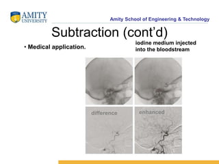 Amity School of Engineering & Technology 
Subtraction (cont’d) 
• Medical application. 
iodine medium injected 
into the bloodstream 
difference enhanced 
 