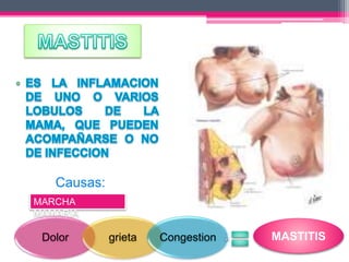 Causas: 
MARCHA 
MAMARIA 
Dolor grieta Congestion MASTITIS 
 
