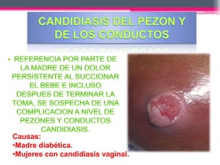 Causas: 
•Madre diabética. 
•Mujeres con candidiasis vaginal. 
 