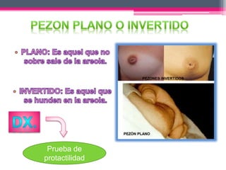 Prueba de 
protactilidad 
 