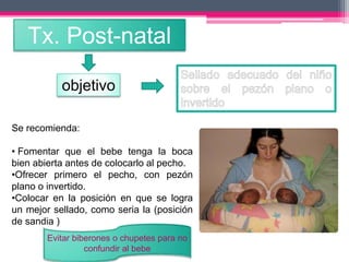 Tx. Post-natal 
objetivo 
Se recomienda: 
• Fomentar que el bebe tenga la boca 
bien abierta antes de colocarlo al pecho. 
•Ofrecer primero el pecho, con pezón 
plano o invertido. 
•Colocar en la posición en que se logra 
un mejor sellado, como seria la (posición 
de sandia ) 
Evitar biberones o chupetes para no 
confundir al bebe 
 