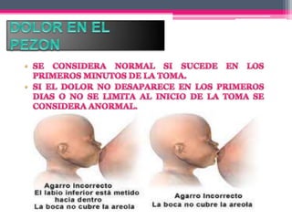 1. problemas de la mama que afectan la lactancia 