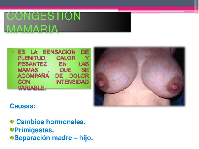 Los ejercicios para el aumento del pecho al adolescente