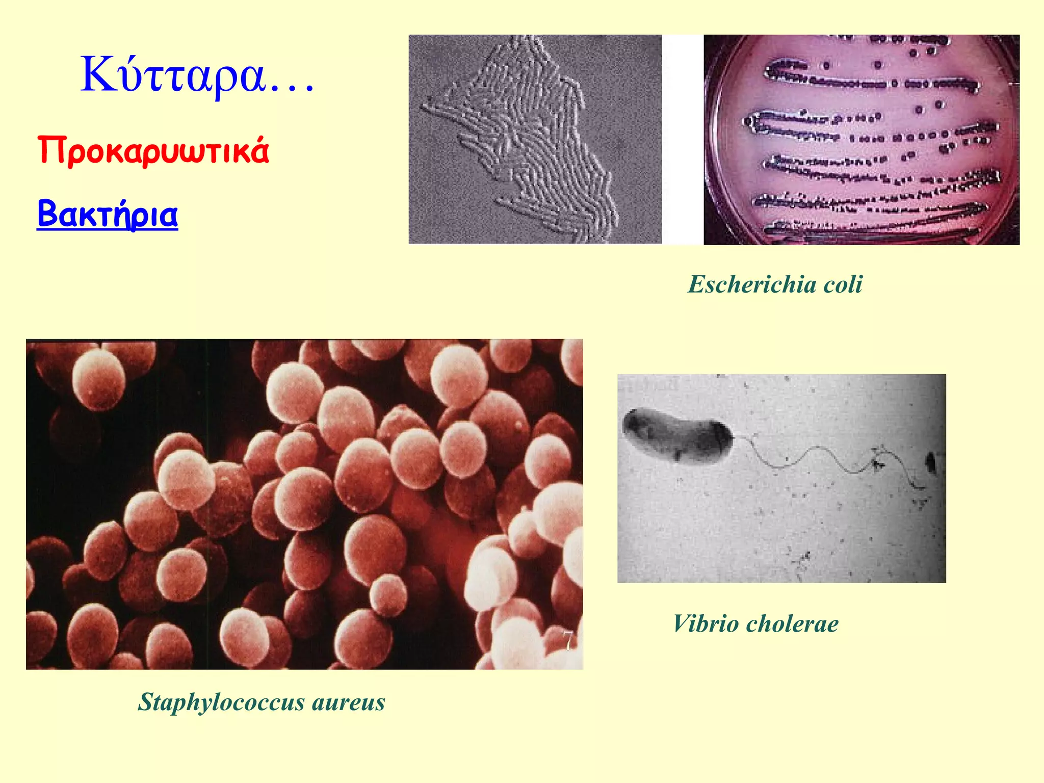 Κύτταρα… 
Προκαρυωτικά 
Βακτήρια 
Staphylococcus aureus 
Escherichia coli 
Vibrio cholerae 
 
