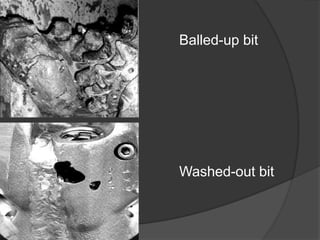 Balled-up bit 
Washed-out bit 