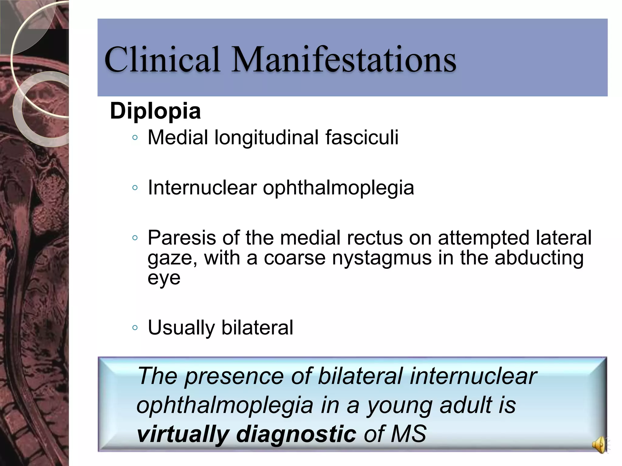 Clinical Manifestations 
Diplopia 
◦ Medial longitudinal fasciculi 
◦ Internuclear ophthalmoplegia 
◦ Paresis of the medial rectus on attempted lateral 
gaze, with a coarse nystagmus in the abducting 
eye 
◦ Usually bilateral 
The presence of bilateral internuclear 
ophthalmoplegia in a young adult is 
virtually diagnostic of MS 
 