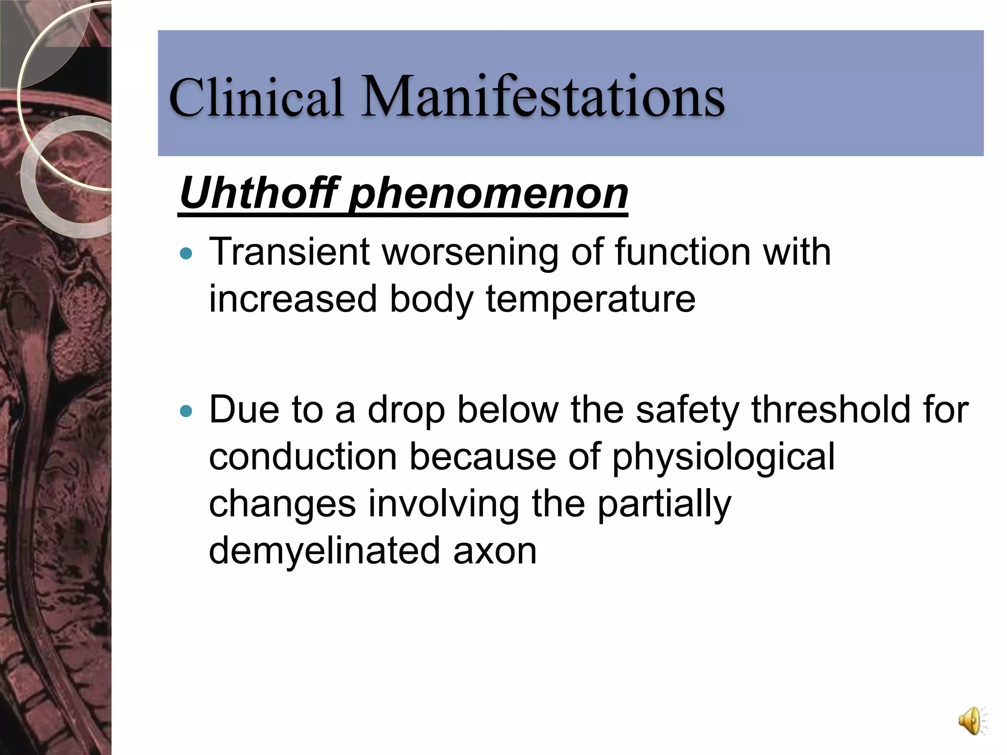 Clinical Manifestations 
Uhthoff phenomenon 
 Transient worsening of function with 
increased body temperature 
 Due to a drop below the safety threshold for 
conduction because of physiological 
changes involving the partially 
demyelinated axon 
 