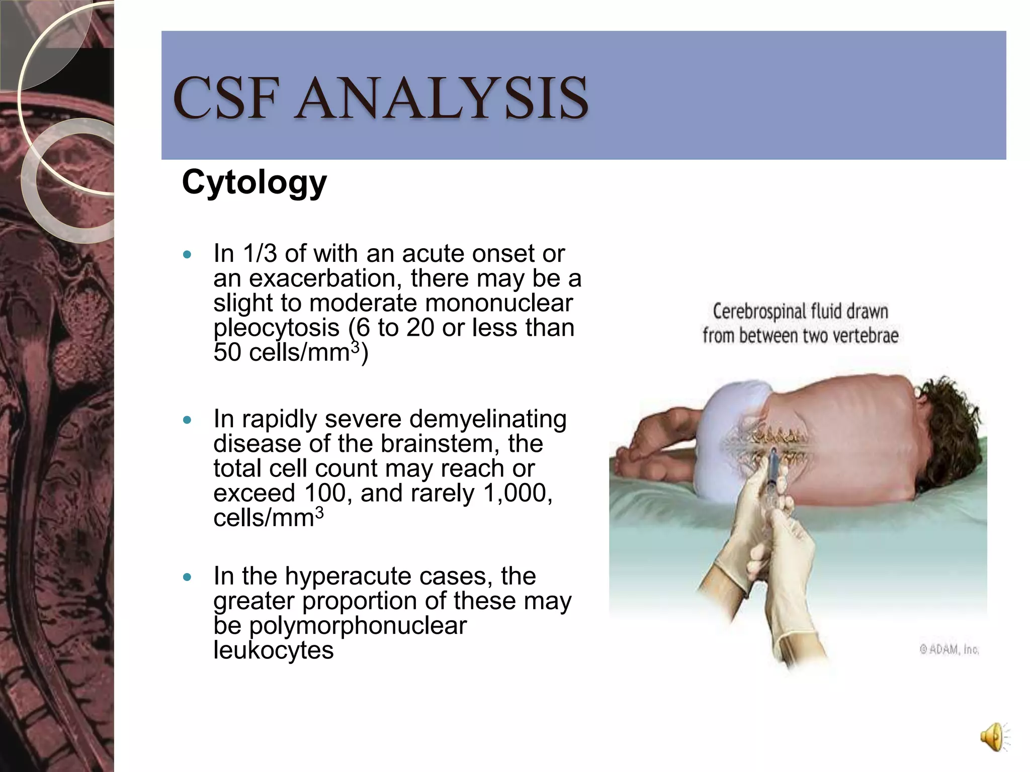 CSF ANALYSIS 
Cytology 
 In 1/3 of with an acute onset or 
an exacerbation, there may be a 
slight to moderate mononuclear 
pleocytosis (6 to 20 or less than 
50 cells/mm3) 
 In rapidly severe demyelinating 
disease of the brainstem, the 
total cell count may reach or 
exceed 100, and rarely 1,000, 
cells/mm3 
 In the hyperacute cases, the 
greater proportion of these may 
be polymorphonuclear 
leukocytes 
 