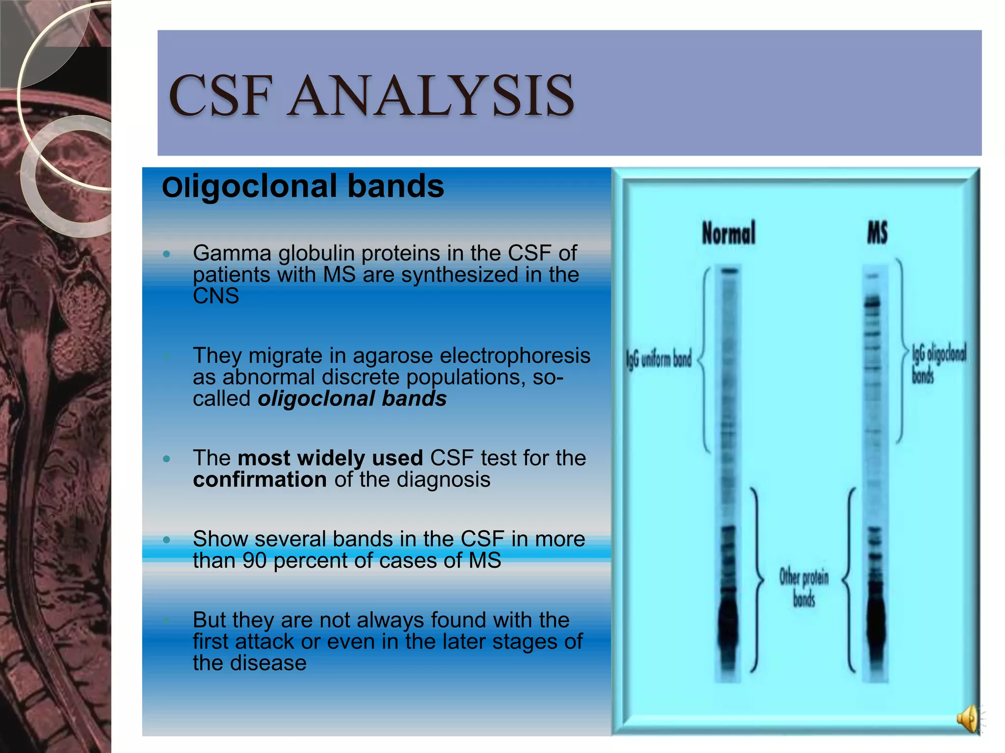 CSF ANALYSIS 
Oligoclonal bands 
 Gamma globulin proteins in the CSF of 
patients with MS are synthesized in the 
CNS 
 They migrate in agarose electrophoresis 
as abnormal discrete populations, so-called 
oligoclonal bands 
 The most widely used CSF test for the 
confirmation of the diagnosis 
 Show several bands in the CSF in more 
than 90 percent of cases of MS 
 But they are not always found with the 
first attack or even in the later stages of 
the disease 
 