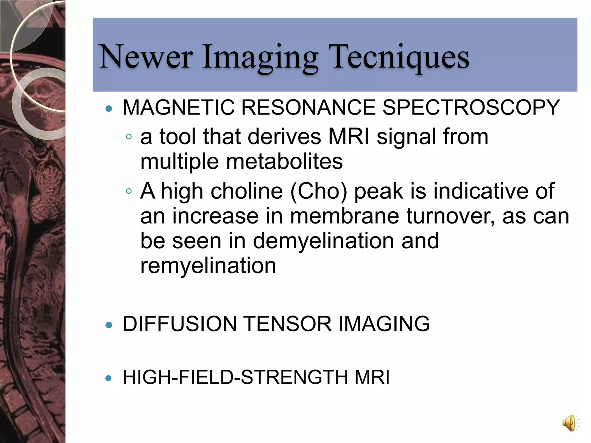 Newer Imaging Tecniques 
 MAGNETIC RESONANCE SPECTROSCOPY 
◦ a tool that derives MRI signal from 
multiple metabolites 
◦ A high choline (Cho) peak is indicative of 
an increase in membrane turnover, as can 
be seen in demyelination and 
remyelination 
 DIFFUSION TENSOR IMAGING 
 HIGH-FIELD-STRENGTH MRI 
 
