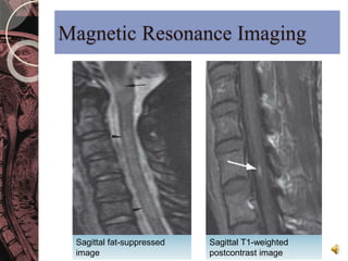 Magnetic Resonance Imaging 
Sagittal fat-suppressed 
image 
Sagittal T1-weighted 
postcontrast image 
 