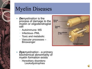 Myelin Diseases 
 Demyelination is the 
process of damage to the 
myelin or oligodendroglial 
cell 
◦ Autoimmune- MS 
◦ Infectious- PML 
◦ Toxic and metabolic 
◦ Vascular processes – 
Binswanger 
 Dysmyelination - a primary 
biochemical abnormality of 
myelin formation exists 
◦ Hereditary disorders- 
Leukodystrophies 
 