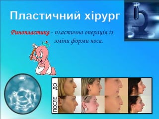Ринопластика - пластична операція із 
зміни форми носа. 
 