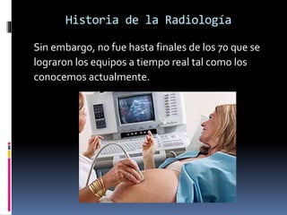 Historia de la Radiología 
Sin embargo, no fue hasta finales de los 70 que se 
lograron los equipos a tiempo real tal como los 
conocemos actualmente. 
 
