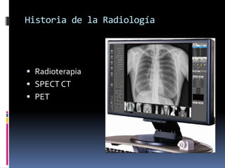 Historia de la Radiología 
 Radioterapia 
 SPECT CT 
 PET 
 