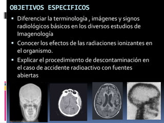 OBJETIVOS ESPECIFICOS 
 Diferenciar la terminología , imágenes y signos 
radiológicos básicos en los diversos estudios de 
Imagenología 
 Conocer los efectos de las radiaciones ionizantes en 
el organismo. 
 Explicar el procedimiento de descontaminación en 
el caso de accidente radioactivo con fuentes 
abiertas 
 