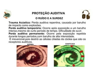 PROTEÇÃO AUDITIVA 
O RUÍDO E A SURDEZ 
Trauma Acústico: Perda auditiva repentina, causada por barulho 
de impacto como explosões. 
Perda auditiva temporária: Ocorre após exposição a um barulho 
intenso,mesmo de curto período de tempo. Dificuldade de ouvir. 
Perda auditiva permanente: Ocorre pela exposição repetida 
durante longos períodos,com barulho de alta intensidade. 
É irreversível,pois destrói as células ciliadas da cóclea que são os 
receptores auditivos. 
NORMAL DANIFICADA 
 