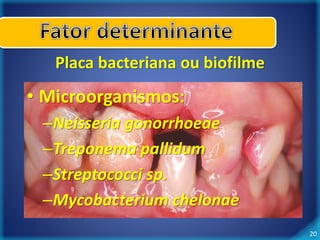 20 
Placa bacteriana ou biofilme 
• Microorganismos: 
–Neisseria gonorrhoeae 
–Treponema pallidum 
–Streptococci sp. 
–Mycobacterium chelonae 
 
