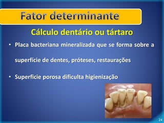 24 
Cálculo dentário ou tártaro 
• Placa bacteriana mineralizada que se forma sobre a 
superfície de dentes, próteses, restaurações 
• Superficie porosa dificulta higienização 
 