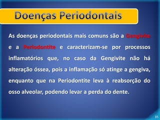 35 
As doenças periodontais mais comuns são a Gengivite 
e a Periodontite e caracterizam-se por processos 
inflamatórios que, no caso da Gengivite não há 
alteração óssea, pois a inflamação só atinge a gengiva, 
enquanto que na Periodontite leva à reabsorção do 
osso alveolar, podendo levar a perda do dente. 
 