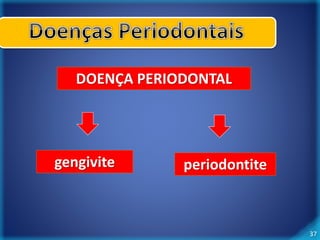 37 
DOENÇA PERIODONTAL 
gengivite periodontite 
 