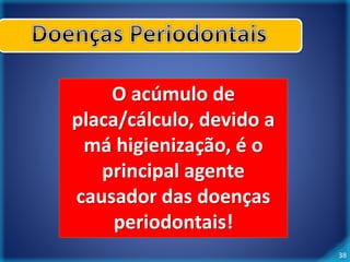 38 
O acúmulo de 
placa/cálculo, devido a 
má higienização, é o 
principal agente 
causador das doenças 
periodontais! 
 