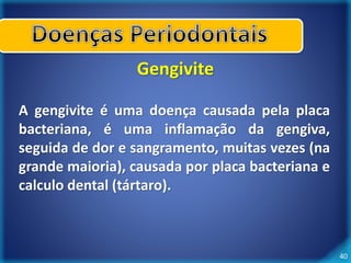 40 
Gengivite 
A gengivite é uma doença causada pela placa 
bacteriana, é uma inflamação da gengiva, 
seguida de dor e sangramento, muitas vezes (na 
grande maioria), causada por placa bacteriana e 
calculo dental (tártaro). 
 