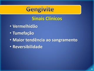 42 
Sinais Clínicos 
• Vermelhidão 
• Tumefação 
• Maior tendência ao sangramento 
• Reversibilidade 
 