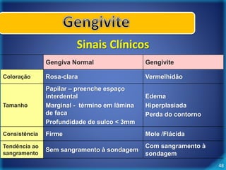 48 
Sinais Clínicos 
Gengiva Normal Gengivite 
Coloração Rosa-clara Vermelhidão 
Tamanho 
Papilar – preenche espaço 
interdental 
Marginal - término em lâmina 
de faca 
Profundidade de sulco < 3mm 
Edema 
Hiperplasiada 
Perda do contorno 
Consistência Firme Mole /Flácida 
Tendência ao 
sangramento 
Sem sangramento à sondagem 
Com sangramento à 
sondagem 
 