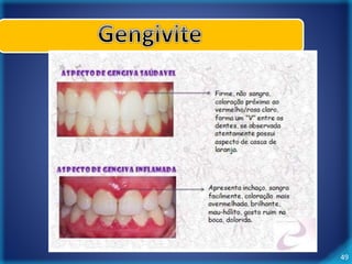 49 
Sinais Clínicos 
 