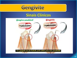 50 
Sinais Clínicos 
 