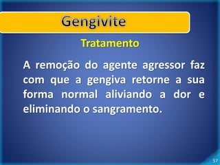 57 
Tratamento 
A remoção do agente agressor faz 
com que a gengiva retorne a sua 
forma normal aliviando a dor e 
eliminando o sangramento. 
 