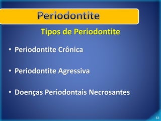 63 
Tipos de Periodontite 
• Periodontite Crônica 
• Periodontite Agressiva 
• Doenças Periodontais Necrosantes 
 