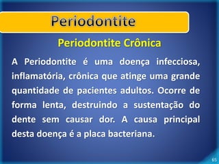 65 
Periodontite Crônica 
A Periodontite é uma doença infecciosa, 
inflamatória, crônica que atinge uma grande 
quantidade de pacientes adultos. Ocorre de 
forma lenta, destruindo a sustentação do 
dente sem causar dor. A causa principal 
desta doença é a placa bacteriana. 
 