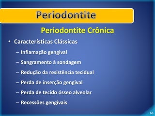 66 
Periodontite Crônica 
• Características Clássicas 
– Inflamação gengival 
– Sangramento à sondagem 
– Redução da resistência tecidual 
– Perda de inserção gengival 
– Perda de tecido ósseo alveolar 
– Recessões gengivais 
 