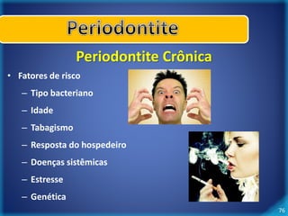 76 
Periodontite Crônica 
• Fatores de risco 
– Tipo bacteriano 
– Idade 
– Tabagismo 
– Resposta do hospedeiro 
– Doenças sistêmicas 
– Estresse 
– Genética 
 