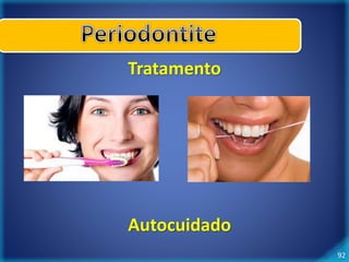 92 
Tratamento 
Autocuidado 
 