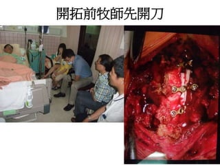 開拓前牧師先開刀 
 