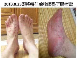 2013.8.25即將轉任前牧師得了腸病毒 
 