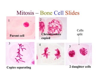 Mitosis – Bone Cell Slides 
1 2 
Parent cell Chromosomes 
copied 
3 4 5 
Cells 
split 
Copies separating 2 daughter cells 
 