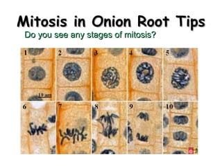 MMiittoossiiss iinn OOnniioonn RRoooott TTiippss 
DDoo yyoouu sseeee aannyy ssttaaggeess ooff mmiittoossiiss?? 
 