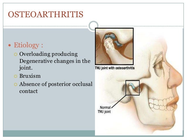 Bd Chaurasia Anatomy Head And Neck Pdf Bd Chaurasia Anatomy Head And Neck Pdf