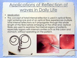 Applications of Reflection of
waves in Daily Life
• Medication
• The concept of total internal reflection is used in optical fibres.
Light entering one end of an optical fibre experiences multiple
total internal reflections as it propagates through the whole
length of the fibre before emerging at the other end. Optical
fibres are used to examine the internal organs of patients,
especially organs with internal cavities such as the colon and
stomach, without operating on the patient.
 