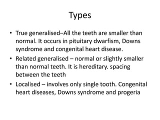 1.microdontia | PPTX