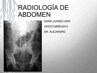 RADIOLOGÍA DE
ABDOMEN
SARAI JUÁREZ 3050
20/OCTUBRE/2014
DR. ALEJANDRO
 