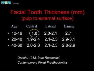 Facial Tooth Thickness (mm)
(pulp to external surface)
•  10-19 1.8 2.0-2.1 2.7
•  20-40 1.9-2.4 2.1-2.3 2.9-3.1
•  40-60 2.0-2.8 2.1-2.3 2.8-2.9
Oshshi, 1968, from Rosenstiel,
Contemporary Fixed Prosthodontics
Age Central Lateral Canine
 